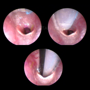 Endoscope visualization of the rabbit trachea